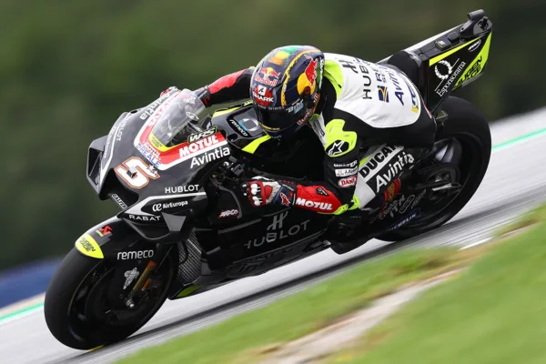 FOR SOCIAL20 Johann undergoes hand surgery